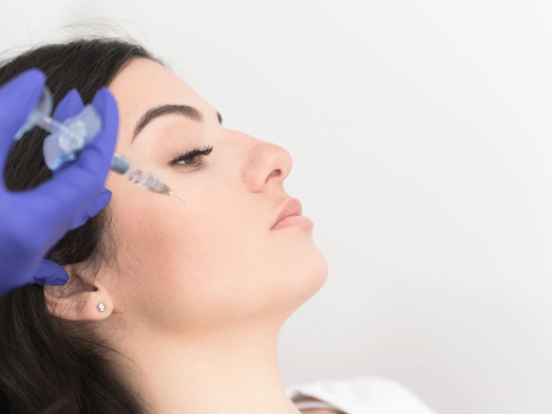 botox and filler duration