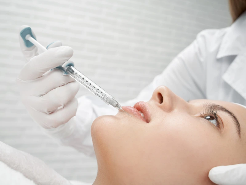 botox and fillers areas