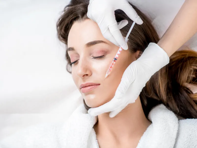 what are dermal fillers smile lines