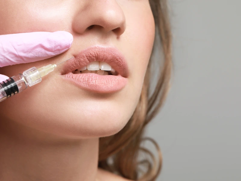 lip fillers treatment procedure