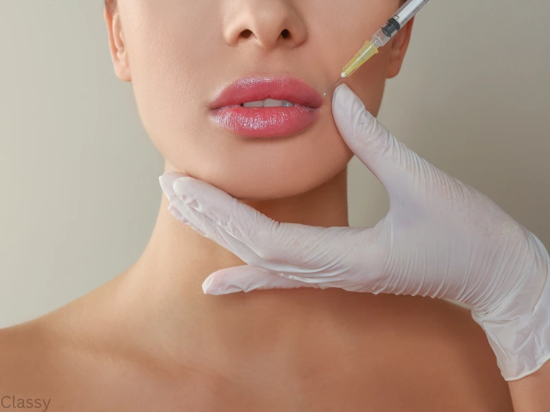 rha collection filler benefits