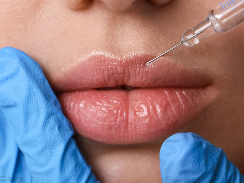 what is rha filler