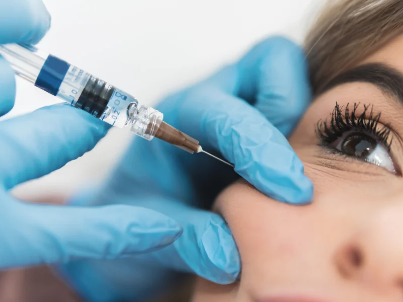 face fillers cost
