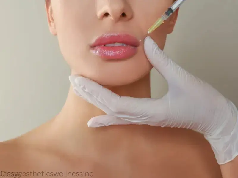 benefits of rha filler