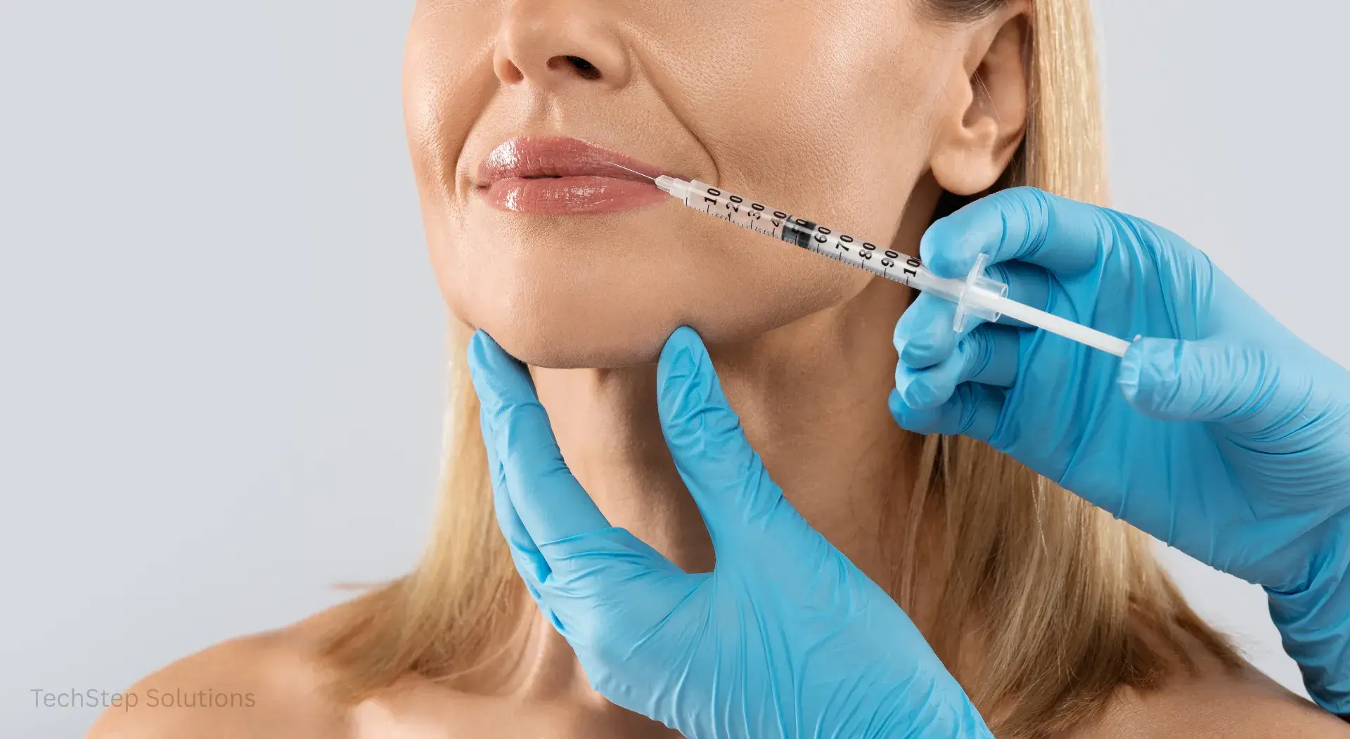 dermal fillers marionette lines