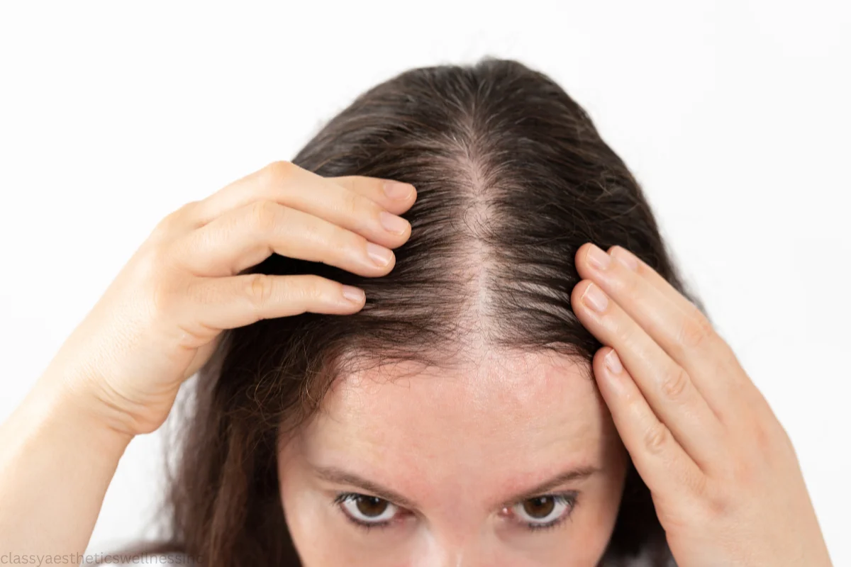 tirzepatide hair loss