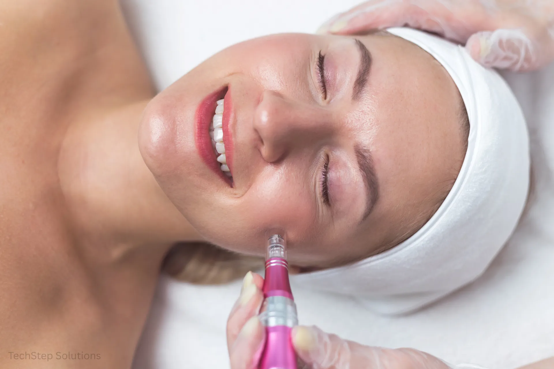 microneedling vs botox
